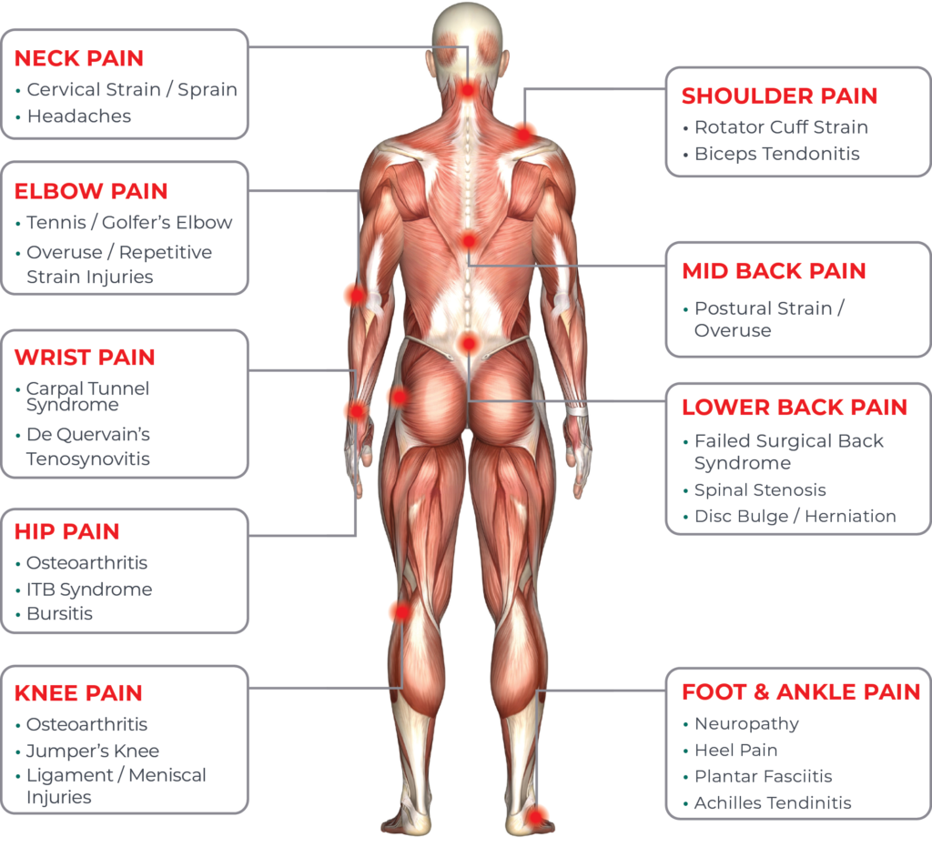 LaserMed Pain Solutions treatment of pain